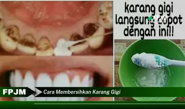 cara membersihkan karang gigi