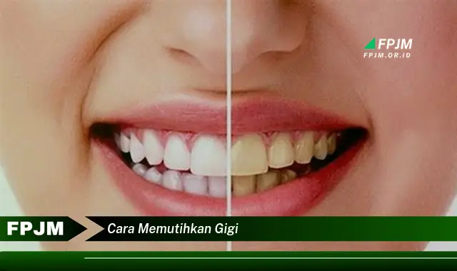 cara memutihkan gigi