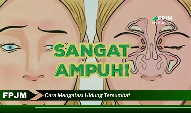 cara mengatasi hidung tersumbat