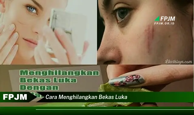 cara menghilangkan bekas luka