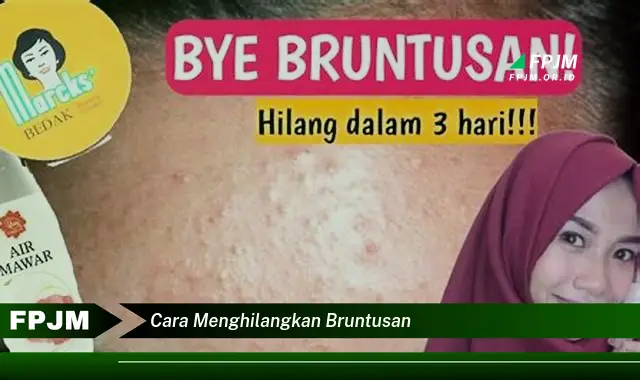 cara menghilangkan bruntusan