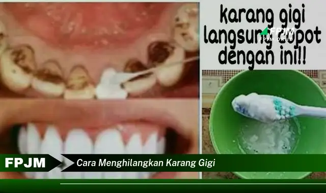 cara menghilangkan karang gigi