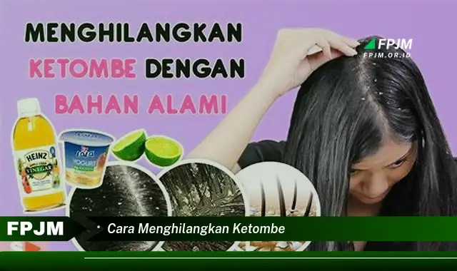 cara menghilangkan ketombe