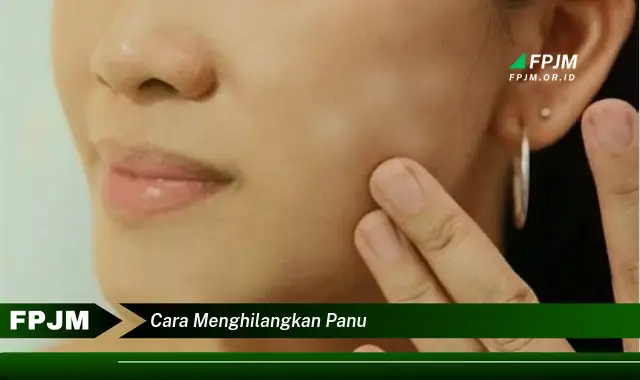 cara menghilangkan panu