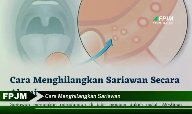 cara menghilangkan sariawan