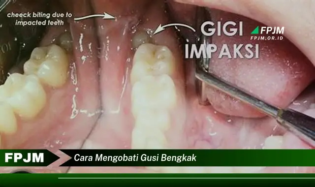 cara mengobati gusi bengkak