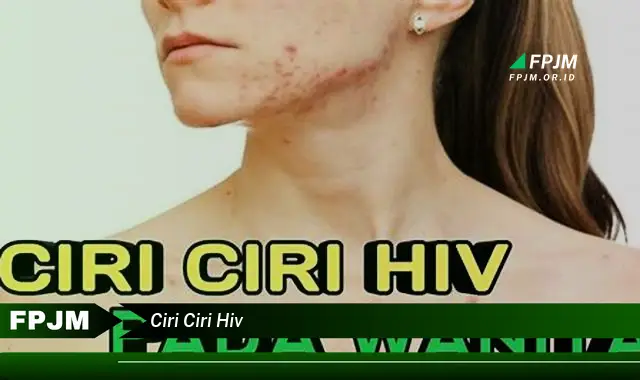 ciri ciri hiv