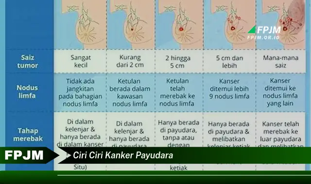 ciri ciri kanker payudara