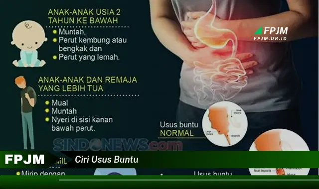 ciri usus buntu ciri usus buntu