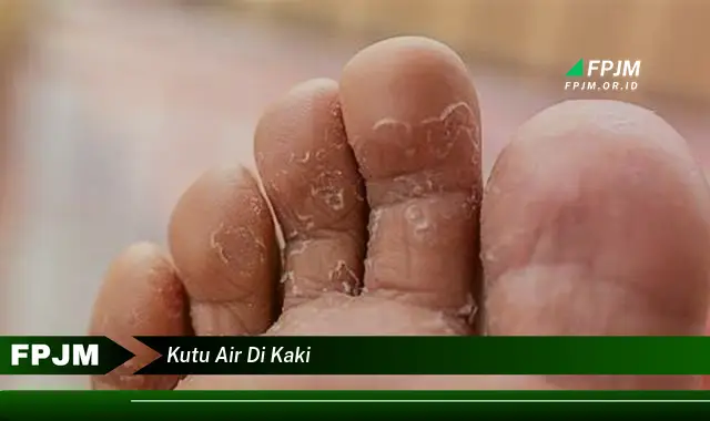 kutu air di kaki