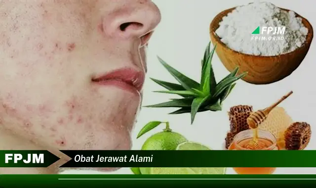 obat jerawat alami