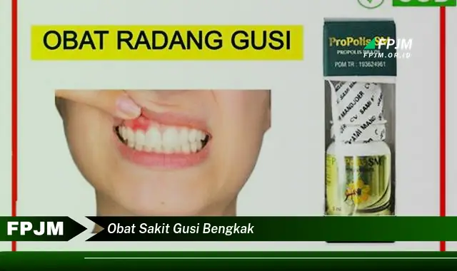 obat sakit gusi bengkak obat sakit gusi bengkak