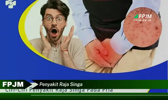 penyakit raja singa