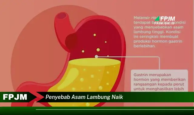 penyebab asam lambung naik