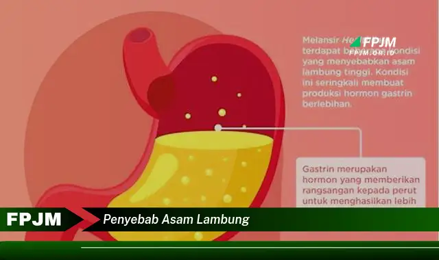 penyebab asam lambung