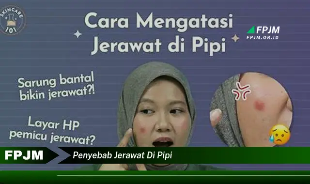 penyebab jerawat di pipi