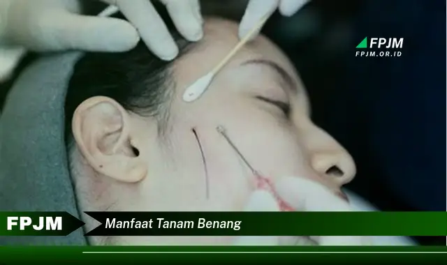 manfaat tanam benang