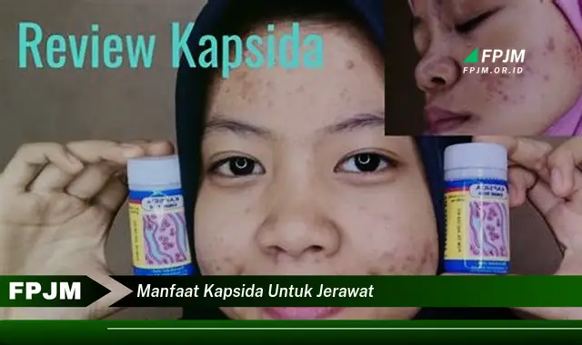 manfaat kapsida untuk jerawat