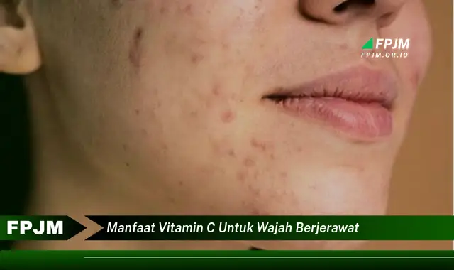 manfaat vitamin c untuk wajah berjerawat manfaat vitamin c untuk wajah berjerawat