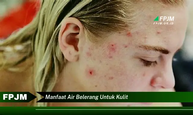 manfaat air belerang untuk kulit