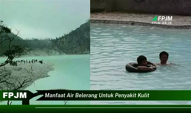 manfaat air belerang untuk penyakit kulit